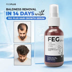 FEG Plus Hair Growth Spray ( Free Delivery All Over Pakistan  )