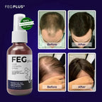 FEG Plus Hair Growth Spray ( Free Delivery All Over Pakistan  )