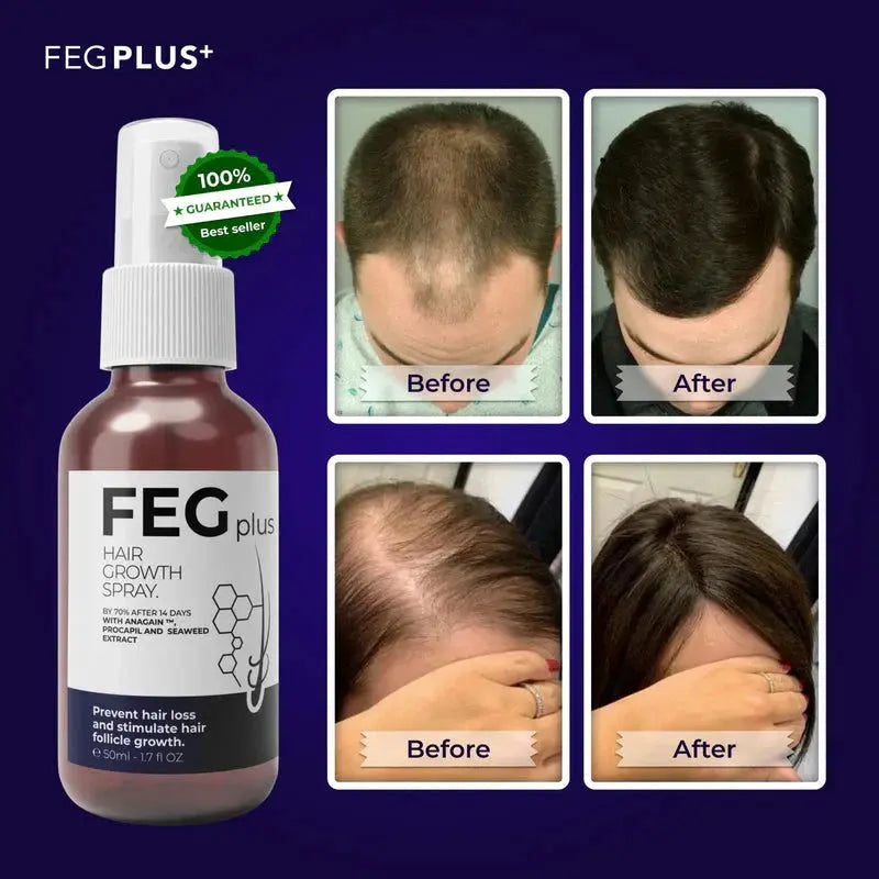 FEG Plus Hair Growth Spray ( Free Delivery All Over Pakistan  )