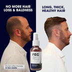 FEG Plus Hair Growth Spray ( Free Delivery All Over Pakistan  )